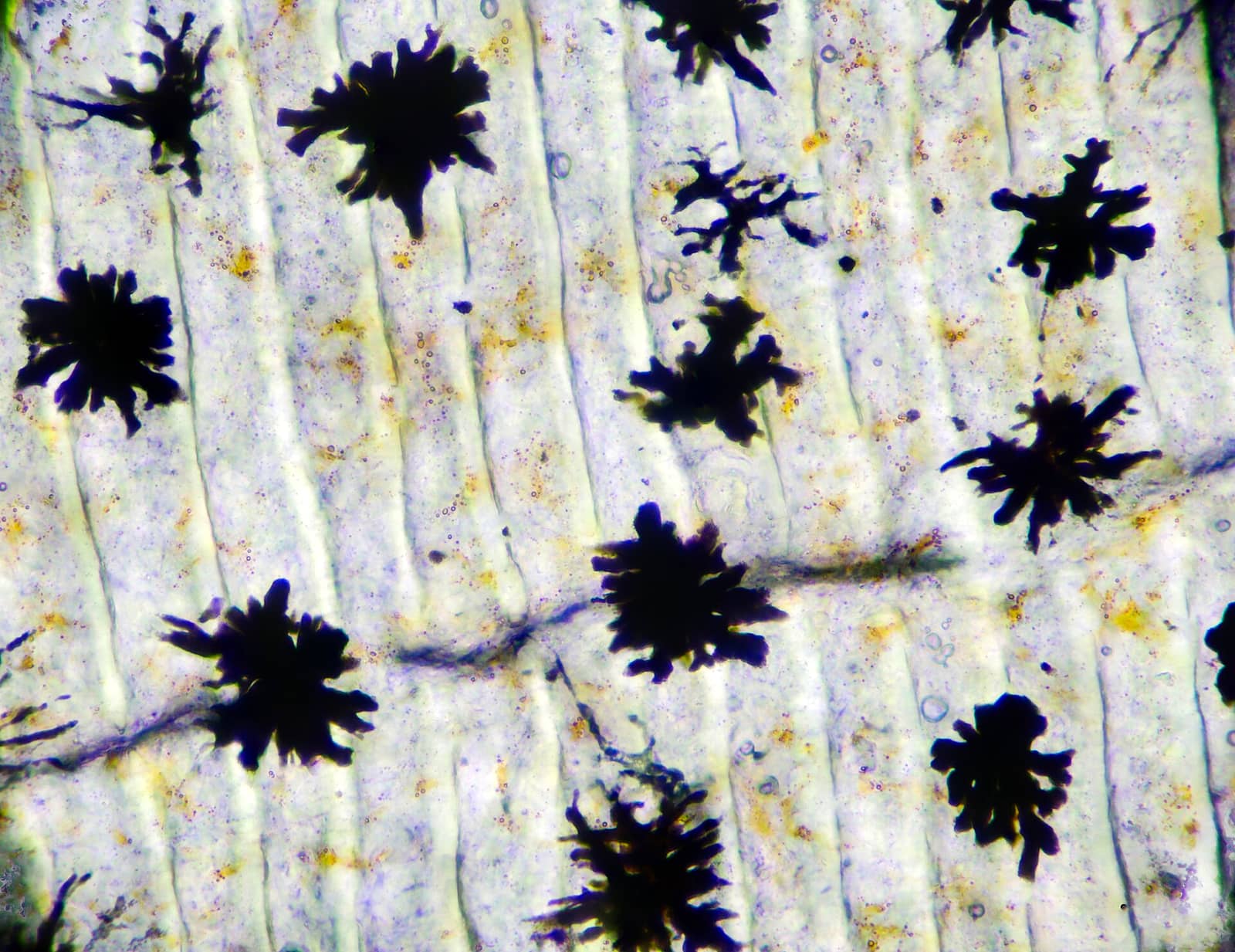 Microscope image at 40x magnification showing dark melanophore pigment cells distributed across translucent fish scales.